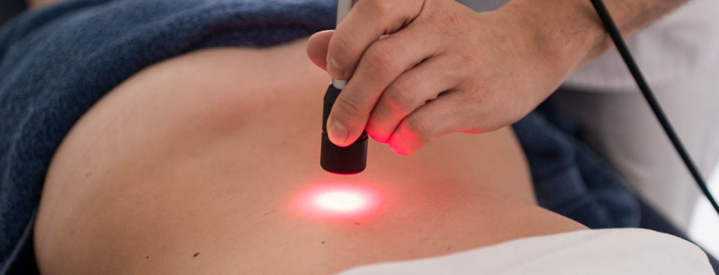 Il Laser a Nd:YAG (Hilterapia®) è un laser a stato solido che sfrutta come mezzo attivo (sorgente di emissione) un cristallo di ittrio e alluminio (YAG) drogato con atomi di Neodimio (Nd). Da qui ne discende il nome Nd:YAG. Tale sorgente emette tipicamente una radiazione luminosa monocromatica caratterizzata da una lunghezza d’onda di 1064 nm (luce nell’infrarosso), con effetti terapeutici ben definiti e scientificamente supportati.